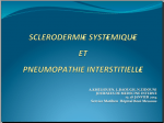 Sclerodermie et pneumopathie interstitielle. A.KHELIOUEN