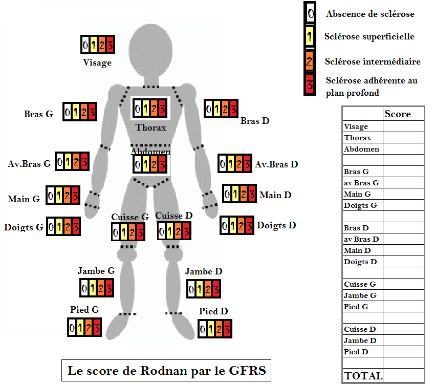 Focus Sur Le Score De Rodnan GFRS Groupe Francophone De Recherche